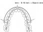 Preview: Arco di distalizzazione molare, misura 7 (98 mm)