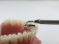 Preview: Tip di ricambio per MiniMold Tiger Dental (morso palatinale)