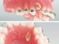 Preview: Catenella dorata per denti retinati