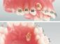 Preview: Catenella dorata per denti retinati, Economy