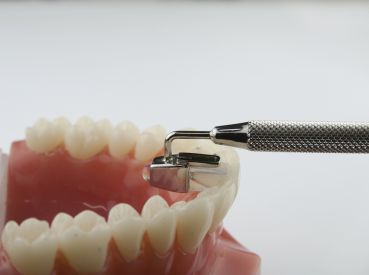 Tip di ricambio per MiniMold Tiger Dental (morso palatinale)