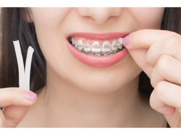 Cera ortodontica, bianco - inodore - Negozio Ortho Depot per ortodontisti,  dentisti e cliniche